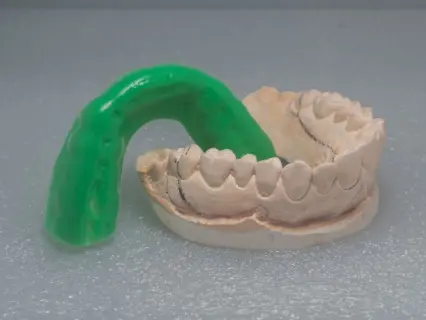 Get a Personalized Sports Mouthguard from your Pediatric Dentist - At Kid Grins