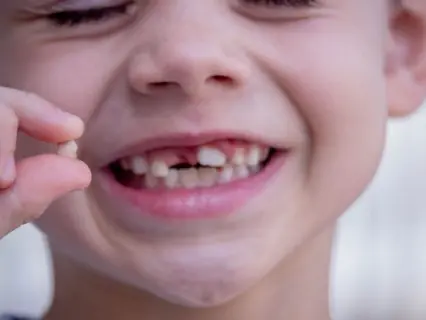 If Your Child Knocks Out Baby Tooth - Kid Grins Is Who You Need To Fix The Knocked Out Tooth