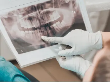 Reasons Kids Need Dental X-Rays - Kid Grins Will Help You Why You Need X-Rays