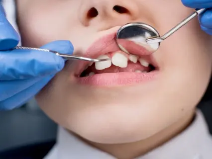 Types of Dental Emergencies for Kids - Kid Grins